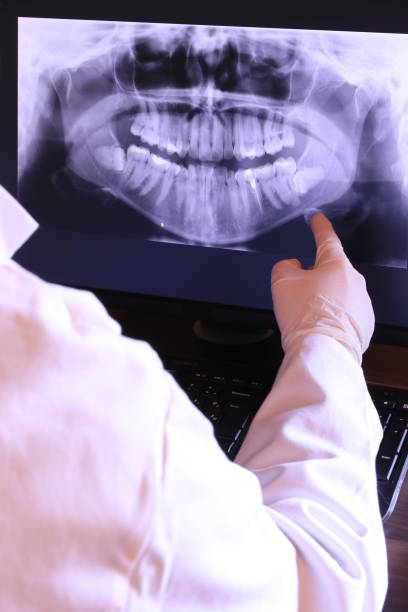 Best Emergency Dentist for Lost Fillings or Crowns in Parowan, UT