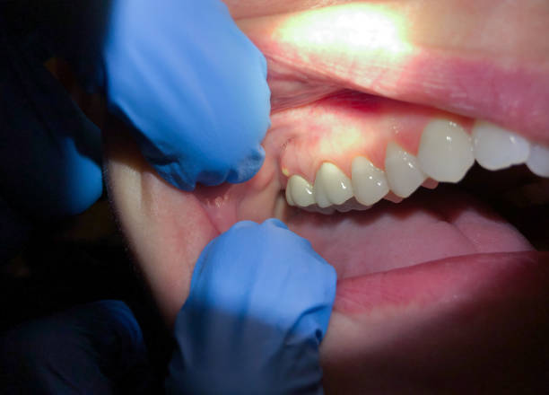 Best Emergency Dental Services for Seniors in Parowan, UT