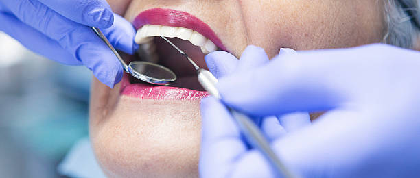 Best Emergency Dental Care for Abscessed Tooth in Parowan, UT