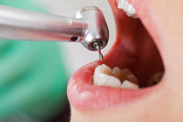 Best Weekend Emergency Dentist in Parowan, UT